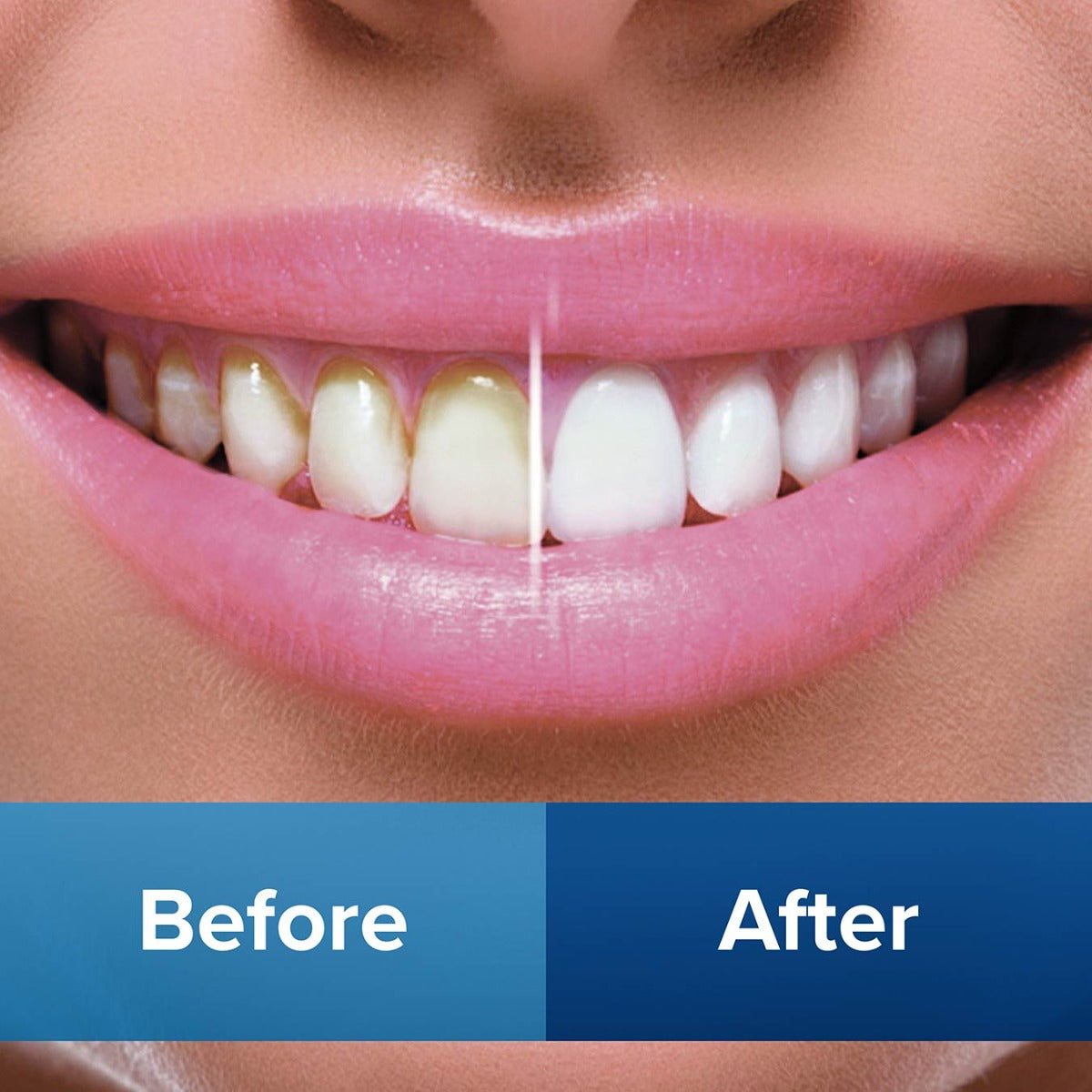 Miracle Smile Water Flosser Complete Kit