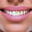 Miracle Smile Water Flosser