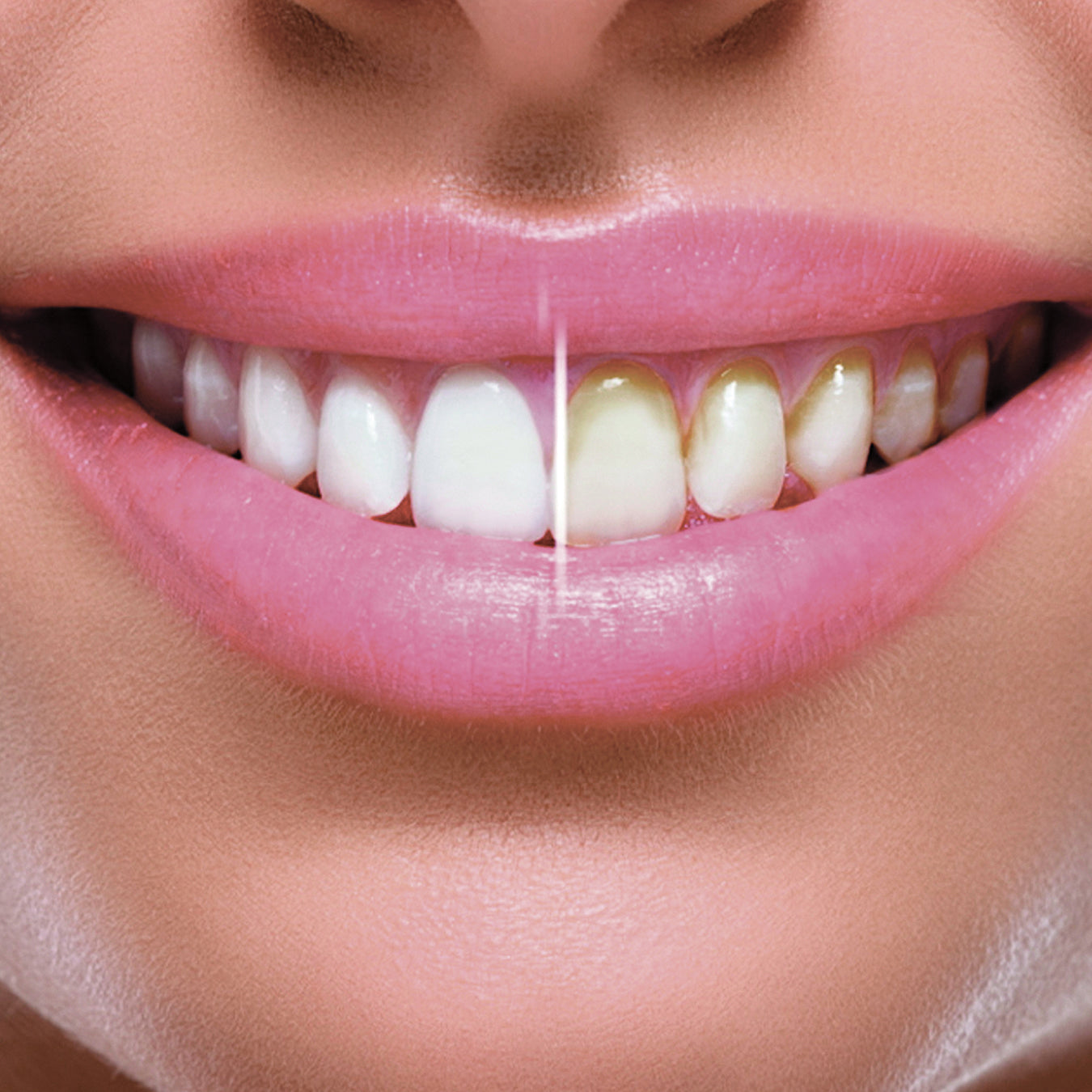 Miracle Smile Water Flosser